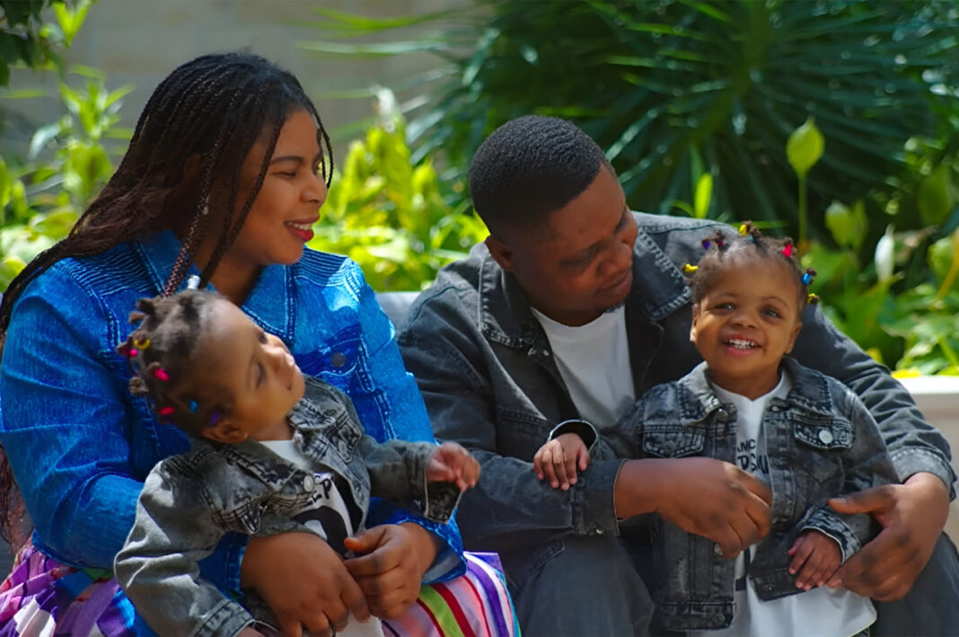 WBB After 15 Months, They Finally Saw Each Other The Miraculous Story of Conjoined Twins Separated in Abu Dhabi