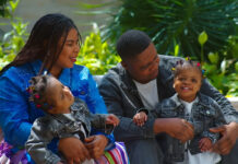 WBB After 15 Months, They Finally Saw Each Other The Miraculous Story of Conjoined Twins Separated in Abu Dhabi